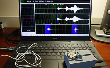 万宝龙手表消磁(免费) 万宝龙手表消磁(免费)